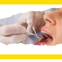 dentiste mou lifo