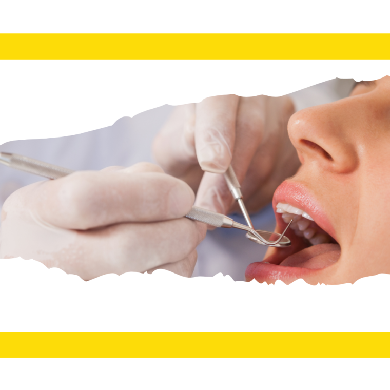 dentiste mou lifo